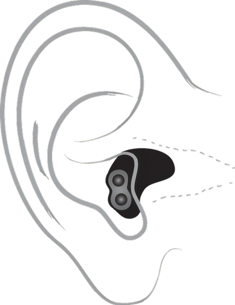 Technical drawing of a custom in-ear headphone design, showcasing its shape and wiring.