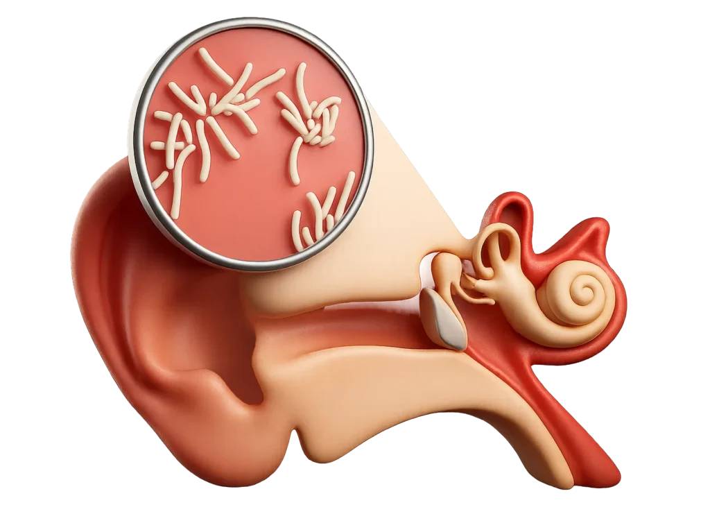 An illustration of the human ear canal showing what sensorineural hearing loss looks like