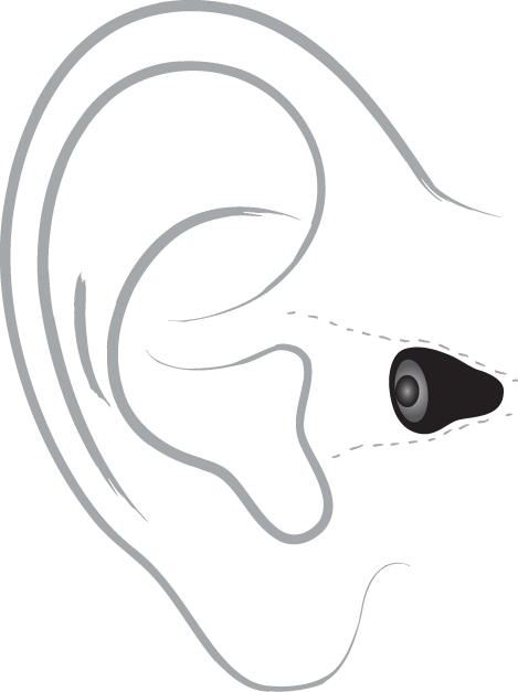 Technical drawing of an invisible in-ear hearing device, outlining its fit within a human ear.